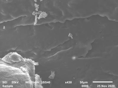 Aspectul microscopic electronic al depunerilor de ceară
