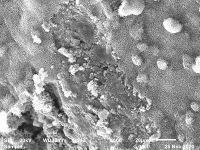 Aspectul microscopic electronic al depunerilor de ceară